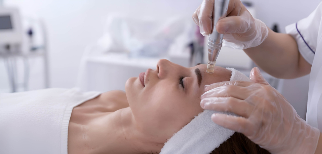 Skin-Needling-Services