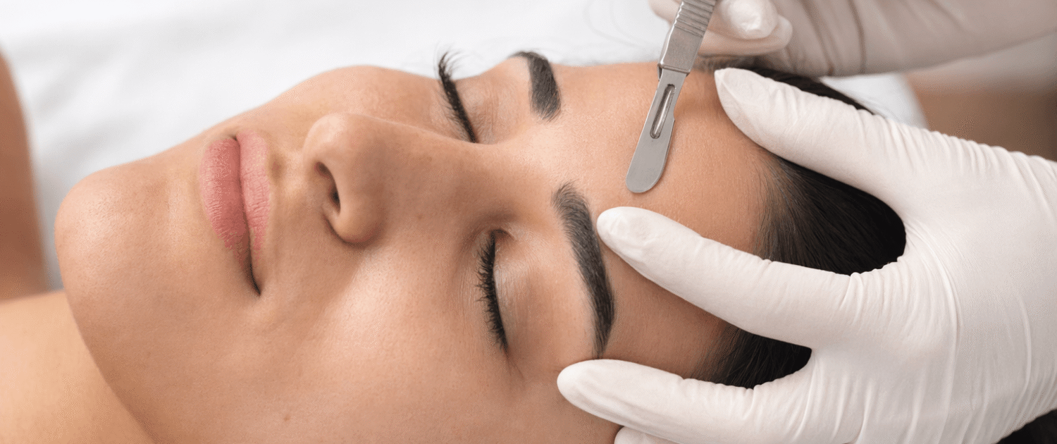 dermaplaning-therapy